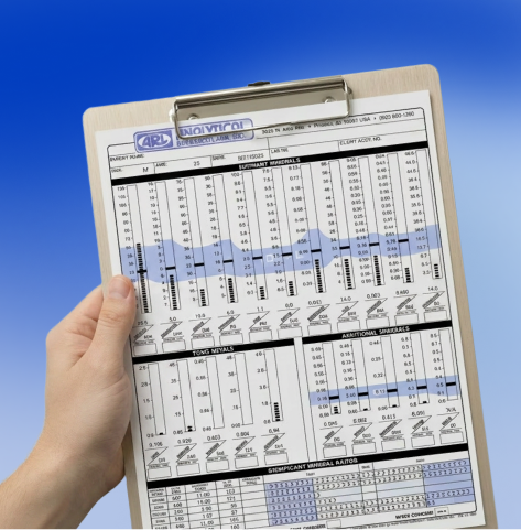 Haarmineralanalyse